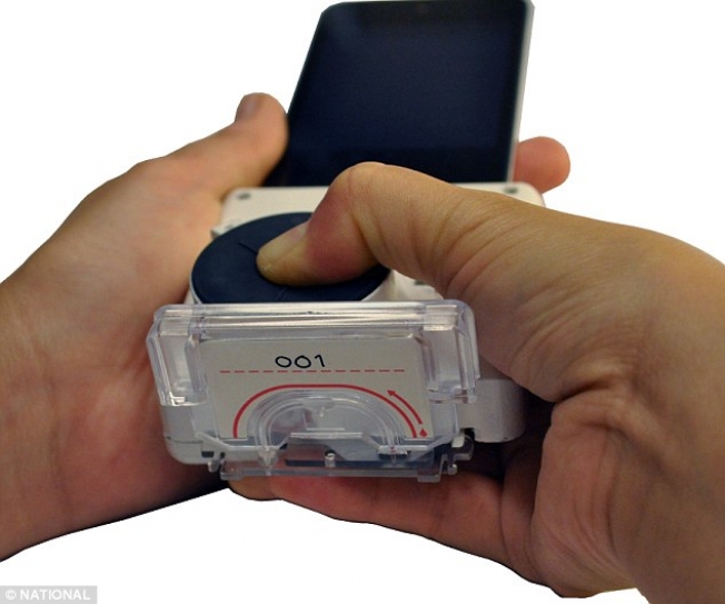 Now there’s a way to diagnose HIV with a smartphone